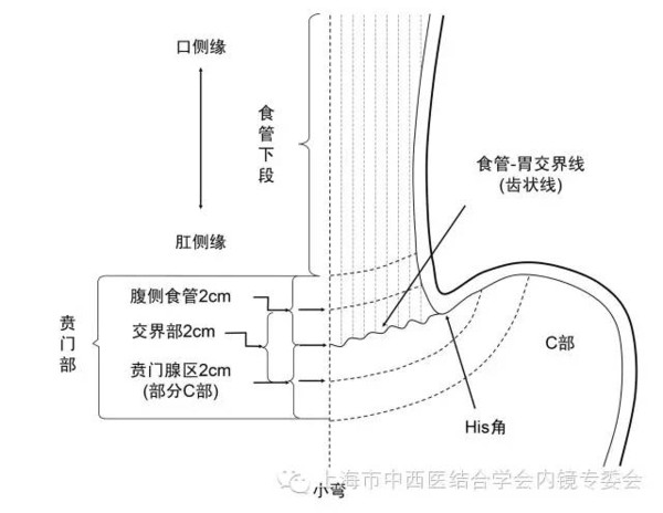 齿状线位置图图片