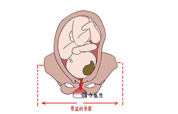 胎儿从母体分娩时,必须通过骨盆