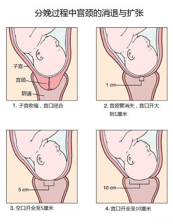 产道是指哪个部位图片