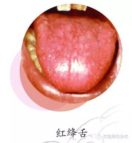 红绛舌常见于图片