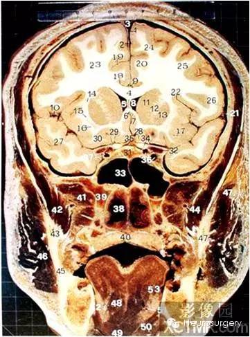 31,額鱗 32,蝶軛 33,前床突 34,蝶骨大翼35,額葉 36,顳葉 37,島葉38