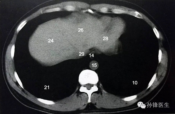 第二肝门ct图片