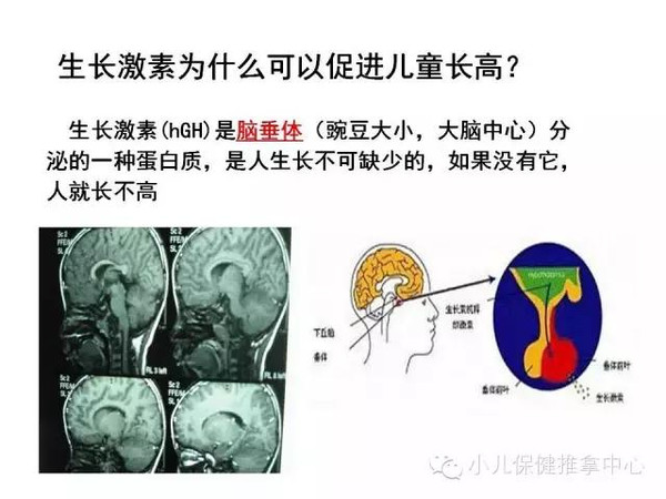 儿童脑垂体大小图片