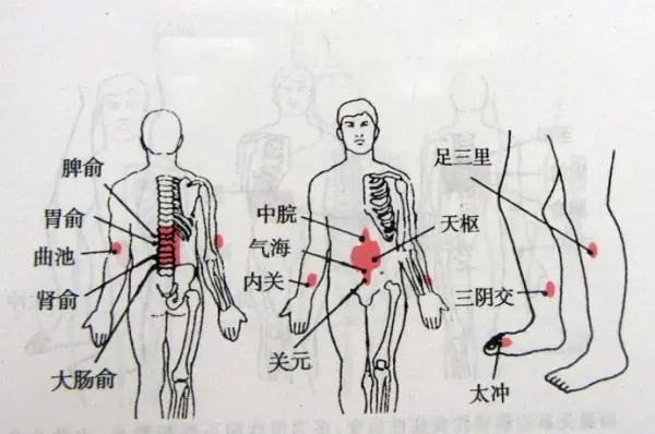 可融合成片,舌質紅,苔黃,常用手法加:①清大腸200次,退六腑100次,清