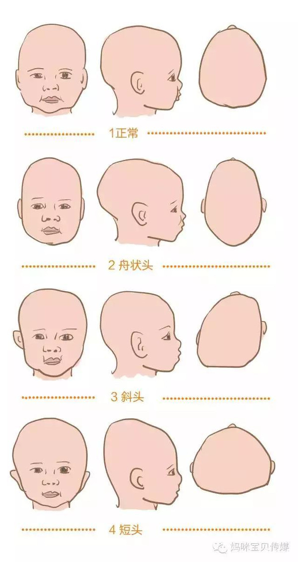 医生给你支招