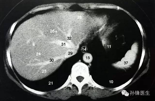 (图)腹部人体断层解剖:经第二肝门的横断层,头颈部ct断层解剖,颌下腺