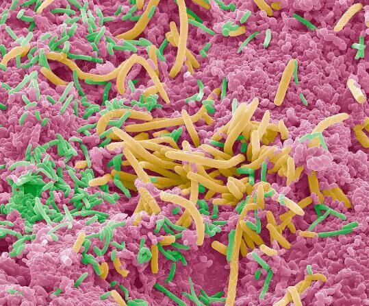 專家帶你一睹顯微鏡下五彩斑斕的口腔細菌(組圖)