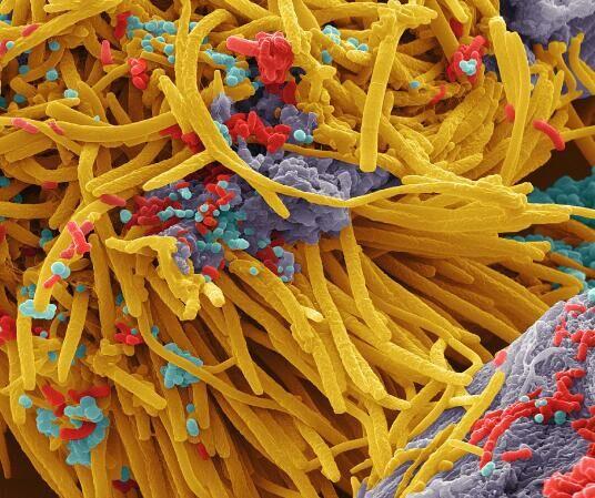 牙菌斑显微镜图片