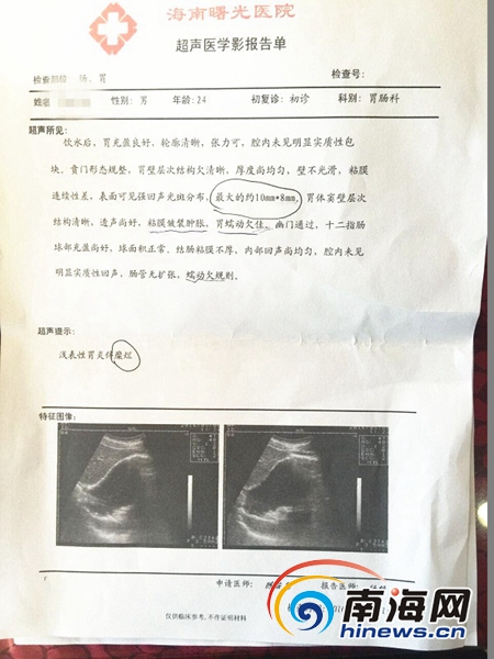 胃肿瘤检查报告单图片图片