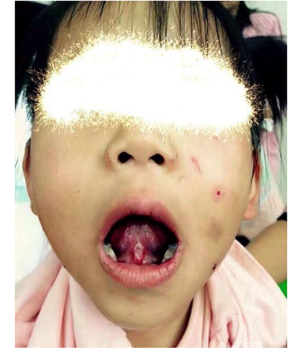 江苏4岁女孩遭恶性虐待浑身是伤警方调查