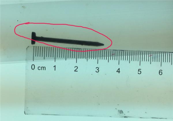 扬子晚报网11月29日消息,一根长近4厘米的铁钉在胃里会怎么样?29日下午4时许,在淮安市妇幼保健院,该院小儿科医生就从一名宿迁泗阳一名13岁女生小轩(化名)的胃里成功取出一根长约4厘米的铁钉,而此时,这根铁钉已经刺破了小轩的胃壁。