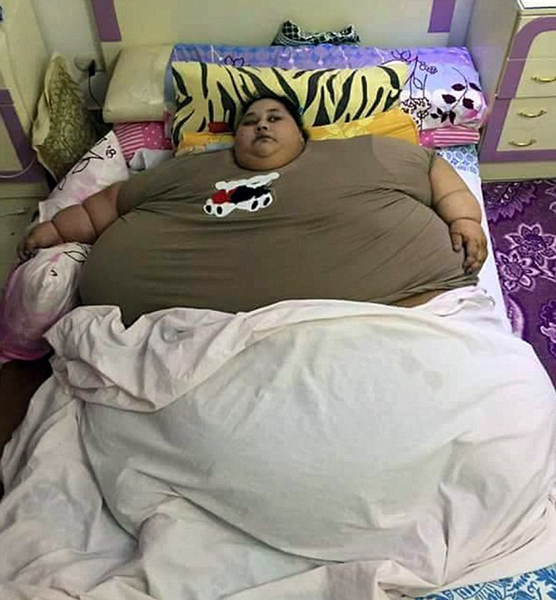 ahmad abdulati)是世界上最胖的女性,体重接近600公斤