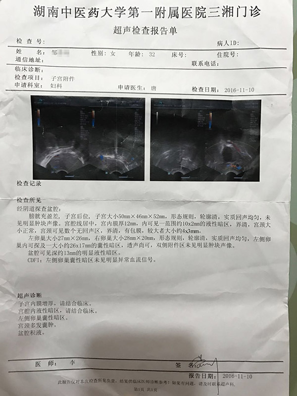 医院b超单图片 一个月图片