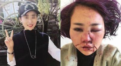 丽江被打毁容女子